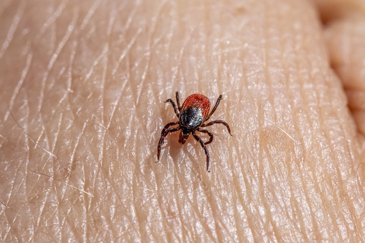 a close up of a tick laying on someone's arm related to The Difference Between Ticks and Bed Bugs: Key Differences You Should Know