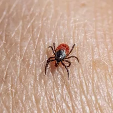 a close up of a tick laying on someone's arm related to The Difference Between Ticks and Bed Bugs: Key Differences You Should Know