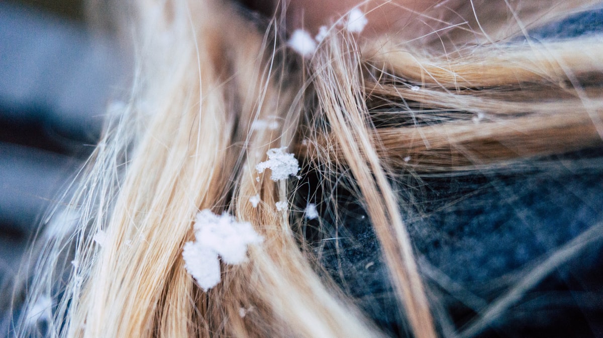 a close up of a woman with snow flakes on her hair related to The Unwelcome Hitchhiker: Dealing with Bed Bugs in Hair