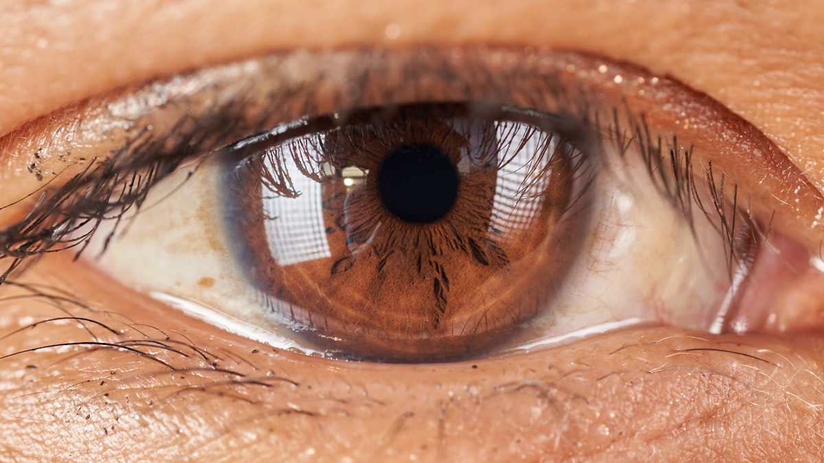 persons eye with black and brown eye related to Coverlet Eye Occlusor