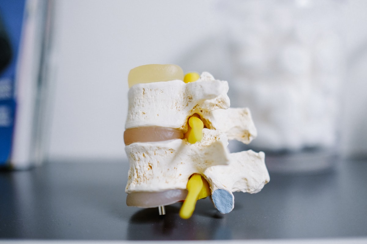 white and yellow cake on white table related to Effective Solutions for Spine Relief During Sleep