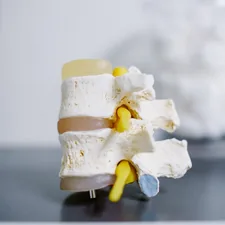 white and yellow cake on white table related to Effective Solutions for Spine Relief During Sleep