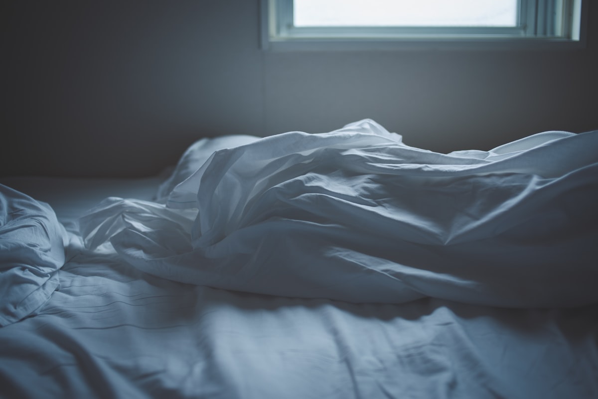 white blanket on bed near window related to Decoding the Mystery: What Do Bed Bug Bites Look Like?